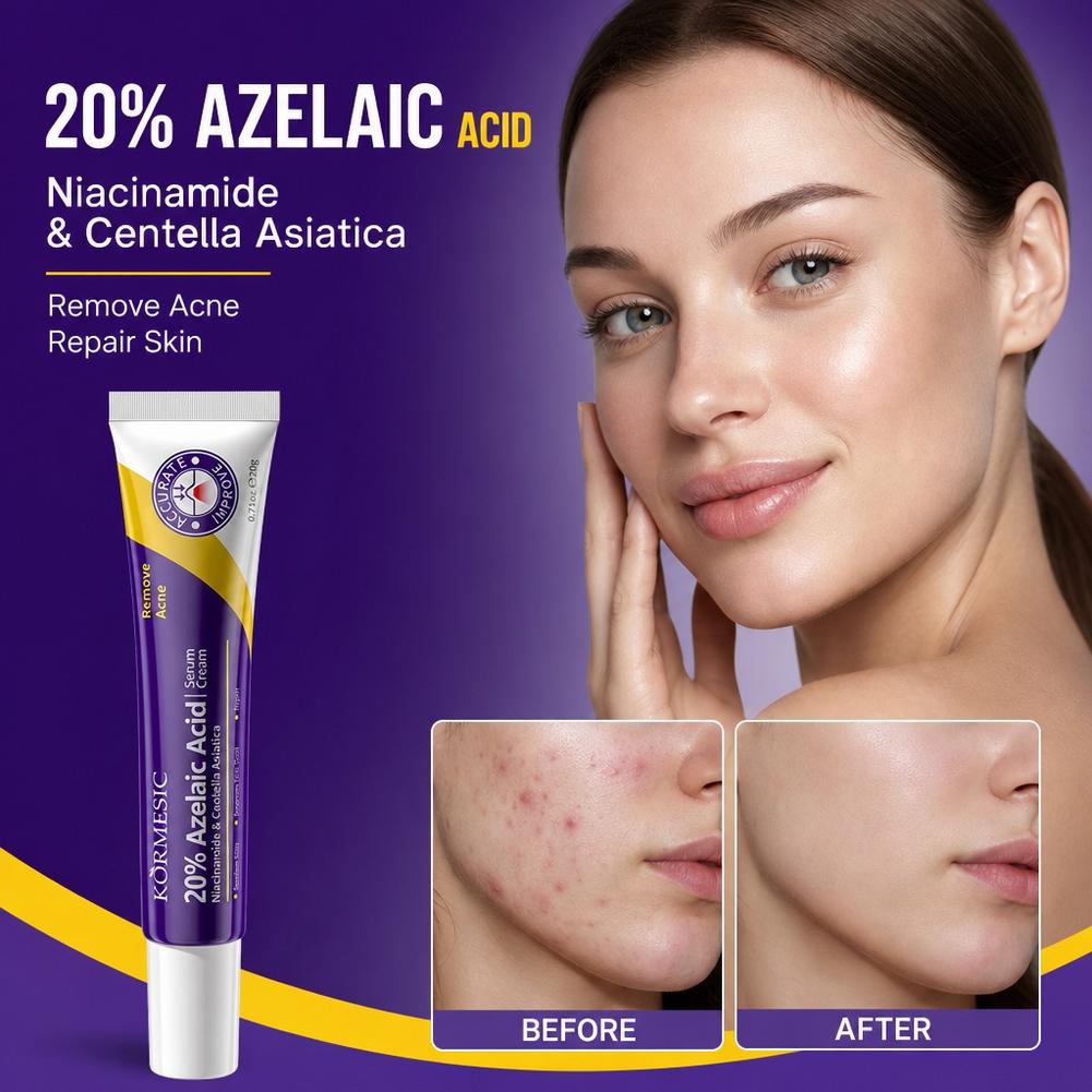 เอสเซนส์กรดอะซีเลอิก 20% ครีมบ - Luxury Skincare Brands บทวิจารณ์และราคา